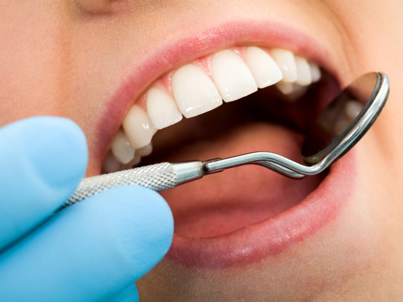 Endodonti (Kanal Tedavisi) uygulaması nasıl yapılır?